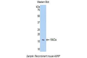 Western Blotting (WB) image for anti-Agouti Related Protein Homolog (Mouse) (AGRP) (AA 21-131) antibody (ABIN1174459) (AGRP antibody  (AA 21-131))