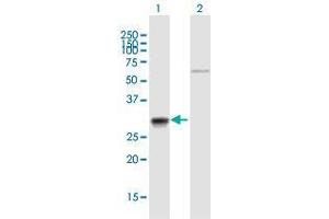Western Blot analysis of CA7 expression in transfected 293T cell line by CA7 MaxPab polyclonal antibody. (CA7 antibody  (AA 1-264))