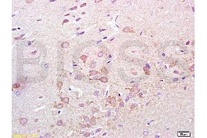 Formalin-fixed and paraffin embedded rat lung tissue labeled with Anti-Synaptotagmin 1/SYT1 Polyclonal Antibody, Unconjugated (ABIN754888) at 1:200 followed by conjugation to the secondary antibody, (SP-0023), and DAB staining (Synaptotagmin antibody  (AA 165-260))