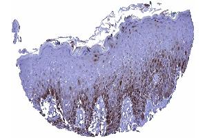 In the skin a nuclear and cytoplasmic Glutamine Synthetase staining can be seen in the lower third and in the top layers of the squamous epithelium (GLN1 antibody  (AA 50-250))