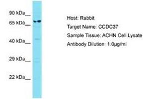 Image no. 1 for anti-Coiled-Coil Domain Containing 37 (CCDC37) (AA 528-577) antibody (ABIN6750799) (CCDC37 antibody  (AA 528-577))