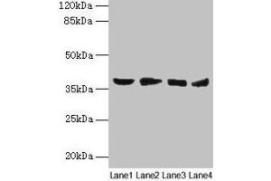 Western blot All lanes: AKR1C2 antibody at 14 μg/mL Lane 1: HepG2 whole cell lysate Lane 2: MCF-7 whole cell lysate Lane 3: Hela whole cell lysate Lane 4: Rat liver tissue Secondary Goat polyclonal to rabbit IgG at 1/10000 dilution Predicted band size: 37, 16 kDa Observed band size: 37 kDa (AKR1C2 antibody  (AA 1-323))