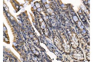 ABIN7094592 and ABIN7098641 at 1/100 staining Mouse colorectal tissue by IHC-P.