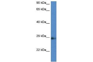 WB Suggested Anti-Ard1b Antibody   Titration: 1. (NAA11 antibody  (Middle Region))