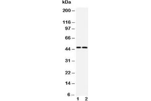 Western blot testing of Caspase-2 antibody and Lane 1:  CEM;  2: SMMC-7721 cell lysate