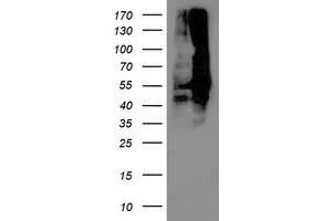 Image no. 1 for anti-Dihydrolipoamide Dehydrogenase (DLD) antibody (ABIN1497849)
