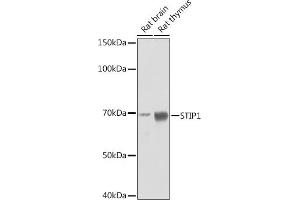 Western blot analysis of extracts of various cell lines, using STIP1 Rabbit mAb (ABIN1512566, ABIN3020619, ABIN3020620 and ABIN7101303) at 1:1000 dilution. (STIP1 antibody)