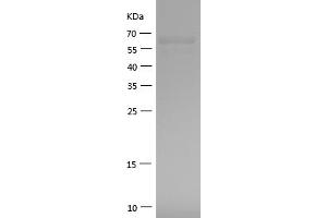 HSPD1 Protein (AA 225-573) (GST tag)