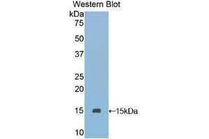 Western blot analysis of the recombinant protein. (SLURP1 antibody  (AA 1-103))