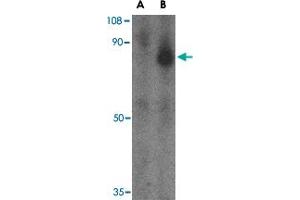Western blot analysis of FEZ1 in SK-N-SH cell lysate with FEZ1 polyclonal antibody  at 1 ug/mL in the (A) presence and (B) absence of blocking peptide.