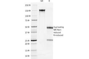 SDS-PAGE Analysis Purified Cytokeratin 7 Mouse Monoclonal Antibody (OV-TL12/30). (Cytokeratin 7 antibody)