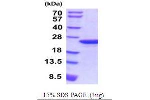 SDS-PAGE (SDS) image for Myosin Regulatory Light Chain 2, Smooth Muscle Isoform (MYL9) (AA 1-172) protein (His tag) (ABIN5854221) (MYL9 Protein (AA 1-172) (His tag))