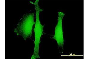 Immunofluorescence of purified MaxPab antibody to AGBL5 on HeLa cell. (AGBL5 antibody  (AA 1-724))