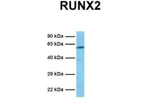 Host:  Rabbit  Target Name:  RUNX2  Sample Tissue:  Human Jurkat  Antibody Dilution:  1. (RUNX2 antibody  (Middle Region))