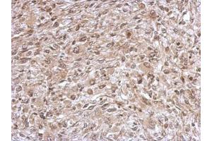 IHC-P Image Immunohistochemical analysis of paraffin-embedded C2C12 xenograft, using TrxR1, antibody at 1:500 dilution. (TXNRD1 antibody)