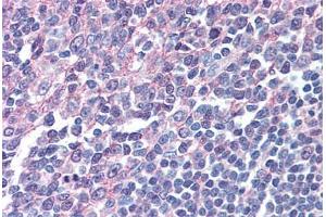 Human Tonsil (Formalin-Fixed Paraffin-Embed) stained with IRF8 antibody ABIN305734 at 5 ug/ml followed by biotinylated anti-goat IgG secondary antibody ABIN481715, alkaline phosphatase-streptavidin and chromogen. (IRF8 antibody  (AA 414-426))