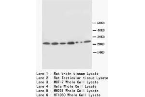 Western blot with SCN1B Polyclonal Antibody