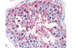 Anti-FSHR antibody IHC of human testis. (FSHR antibody  (N-Term))