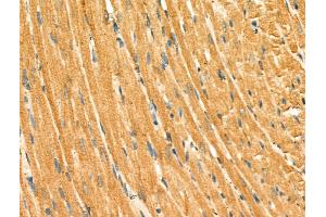 ABIN6264894 and ABIN6266632 at 1/100 staining Rat heart tissue by IHC-P.