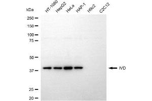 Western blotting analysis using IVD antibody (ABIN7799136).