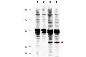 Western blot using FANCF polyclonal antibody  shows detection of FANCF present in a lysate prepared from a Fanconi anemia complementation group F patient lymphoblast after retroviral correction using hFANCF cDNA (lanes 3 and 4). (FANCF antibody  (Internal Region))