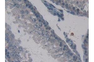 Immunohistochemistry (IHC) image for anti-Coagulation Factor XIII, A1 Polypeptide (F13A1) (AA 140-377) antibody (ABIN7440509)