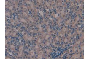 Used in DAB staining on fromalin fixed paraffin- embedded kidney tissue (TMSB4X antibody  (AA 1-44))