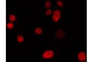 ABIN6274302 staining LOVO cells by IF/ICC. (IRX1 antibody  (Internal Region))