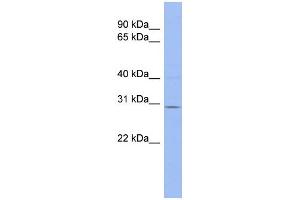 WB Suggested Anti-TRIM14 Antibody Titration:  0. (TRIM14 antibody  (Middle Region))