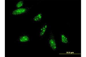 Immunofluorescence of monoclonal antibody to HAND2 on HeLa cell. (HAND2 antibody  (AA 135-216))