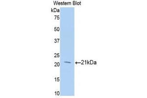 Western Blotting (WB) image for anti-Meningioma Expressed Antigen 5 (Hyaluronidase) (MGEA5) (AA 271-438) antibody (ABIN1859958) (MGEA5 antibody  (AA 271-438))