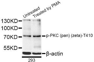 Western blot analysis of extracts of 293 cells, using Phospho-PKC (pan) (zeta)-T410 antibody (ABIN5996150) at 1/1000 dilution. (PKC antibody  (pThr410))