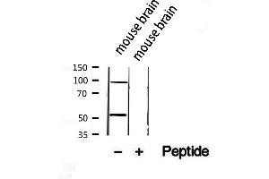 ACADVL antibody  (Internal Region)