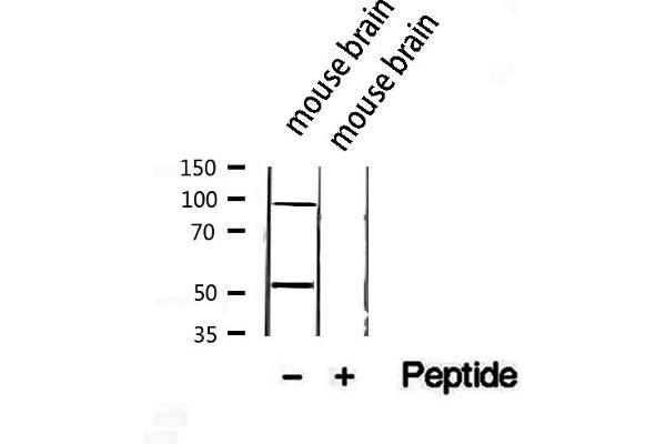 ACADVL antibody  (Internal Region)