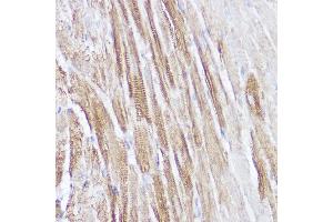 Immunohistochemistry of paraffin-embedded mouse heart using NPPA Rabbit pAb (ABIN7268829) at dilution of 1:100 (40x lens). (NPPA antibody  (AA 26-151))