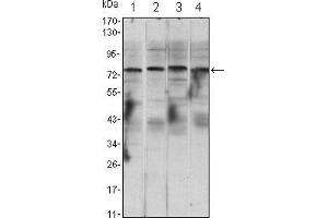 Western blot analysis using CHUK mouse mAb against Raji (1), Jurkat (2), THP-1 (3) and K562 (4) cell lysate. (IKK alpha antibody)