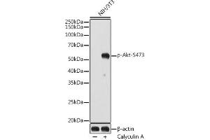 Western blot analysis of extracts of NIH/3T3 cells, using Phospho-Akt-S473 antibody (ABIN7265522) at 1:1000 dilution. (AKT 1/2/3 antibody  (pSer472))