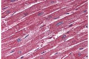 Immunohistochemistry (Formalin/PFA-fixed paraffin-embedded sections) of human heart tissue with TRPM4 polyclonal antibody . (TRPM4 antibody  (N-Term))