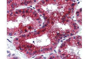 Anti-JMJD2C antibody IHC of human prostate. (KDM4C antibody  (C-Term))