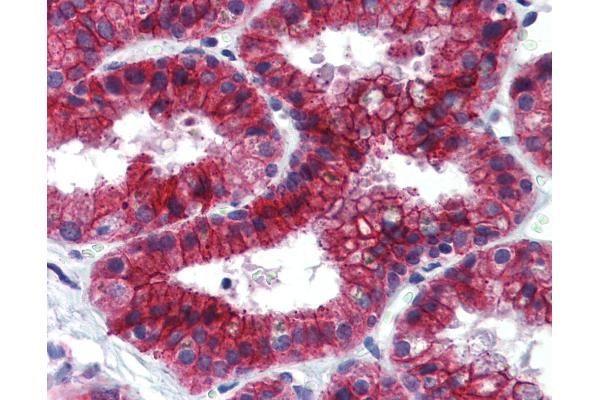KDM4C antibody  (C-Term)