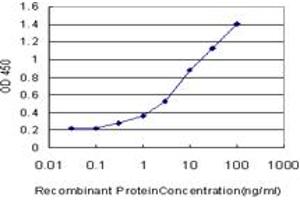 Detection limit for recombinant GST tagged CPT2 is approximately 0. (CPT2 antibody  (AA 351-450))