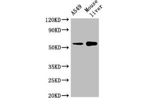 Western Blot Positive WB detected in: A549 whole cell lysate, Mouse liver tissue All lanes: CYP2A13 antibody at 1:2000 Secondary Goat polyclonal to rabbit IgG at 1/50000 dilution Predicted band size: 57 kDa Observed band size: 57 kDa