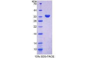 SDS-PAGE analysis of Human CHN2 Protein.