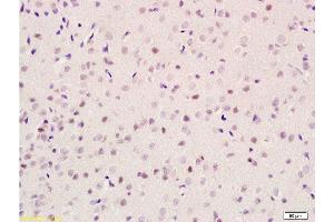 Formalin-fixed and paraffin embedded rat brain tissue labeled with Anti-GIG8/ID2 Polyclonal Antibody, Unconjugated  at 1:100 followed by conjugation to the secondary antibody and DAB staining (Id2 antibody  (AA 31-134))