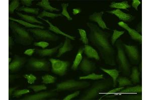Immunofluorescence of purified MaxPab antibody to MALT1 on HeLa cell. (MALT1 antibody  (AA 1-813))