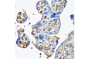 Immunohistochemistry (IHC) image for anti-alpha-2-Macroglobulin (A2M) antibody (ABIN7265558)