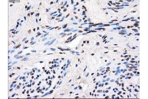 Immunohistochemical staining of paraffin-embedded Ovary tissue using anti-GBE1mouse monoclonal antibody.
