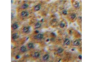 Used in DAB staining on fromalin fixed paraffin-embedded Liver tissue (TFPI antibody  (AA 29-210))