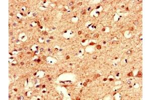 Immunohistochemistry of paraffin-embedded human brain tissue using ABIN7146589 at dilution of 1:100 (Calsyntenin 2 antibody  (AA 473-673))