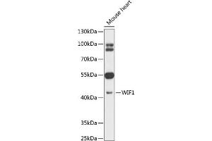 Western blot analysis of extracts of mouse heart, using WIF1 antibody (ABIN6128926, ABIN6150217, ABIN6150219 and ABIN6216799) at 1:1000 dilution. (WIF1 antibody  (AA 29-220))